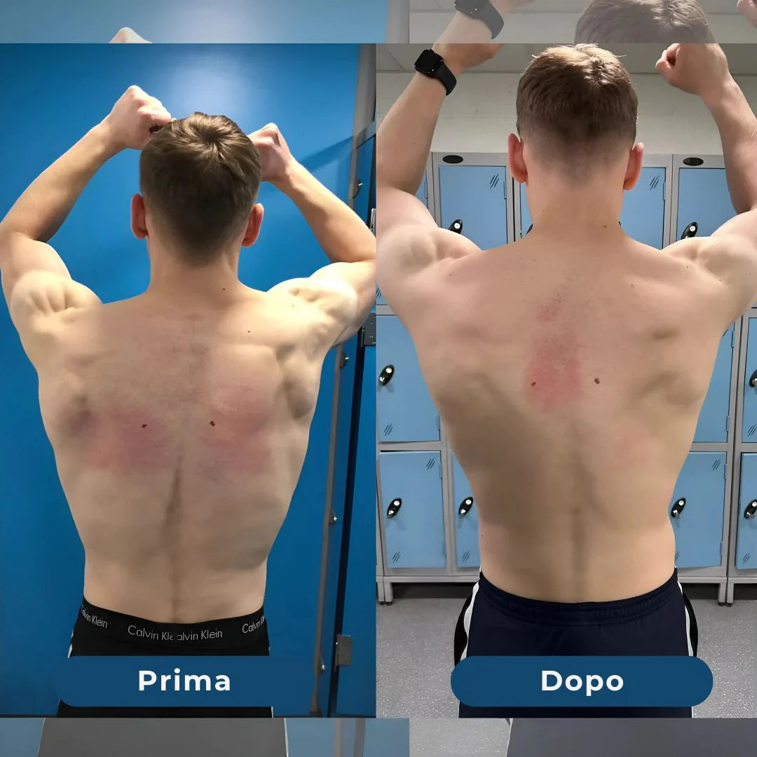 Correttore Posturale SpineFit™ – Sollievo immediato per la schiena