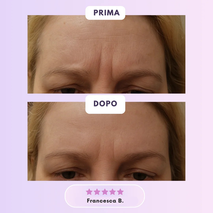 Roddace™ Fogli in silicone al collagene