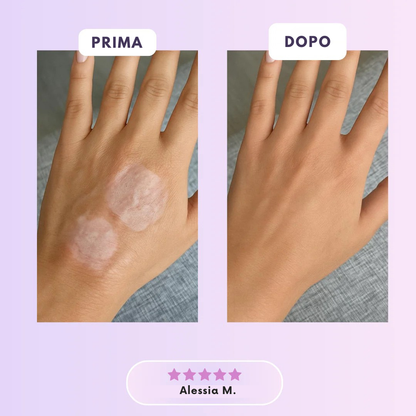 Roddace™ Fogli in silicone al collagene