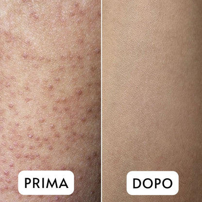 Guanto Esfoliante Premium – Pelle Liscia e Luminosa