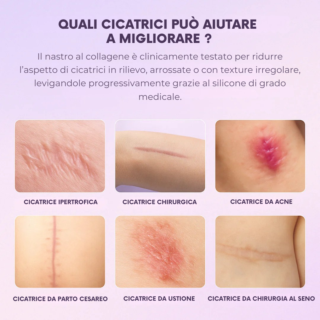 Roddace™ Fogli in silicone al collagene