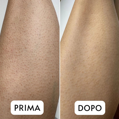 Guanto Esfoliante Premium – Pelle Liscia e Luminosa