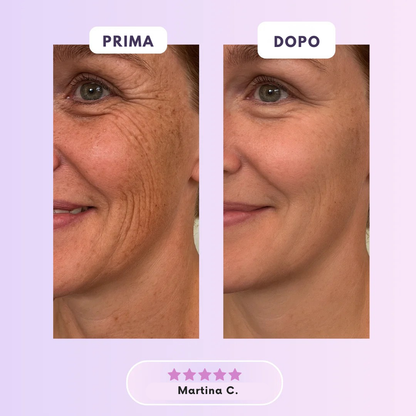 Roddace™ Fogli in silicone al collagene