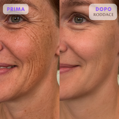 Roddace™ Fogli in silicone al collagene