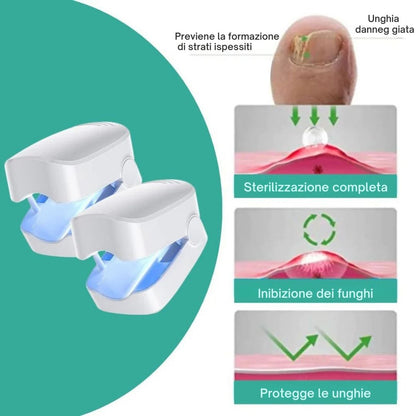 Dispositivo per il trattamento delle unghie incarnite e deformate